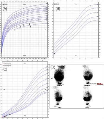 Case Report: Phenotype-Gene Correlation in a Case of Novel Tandem 4q Microduplication With Short Stature, Speech Delay and Microcephaly